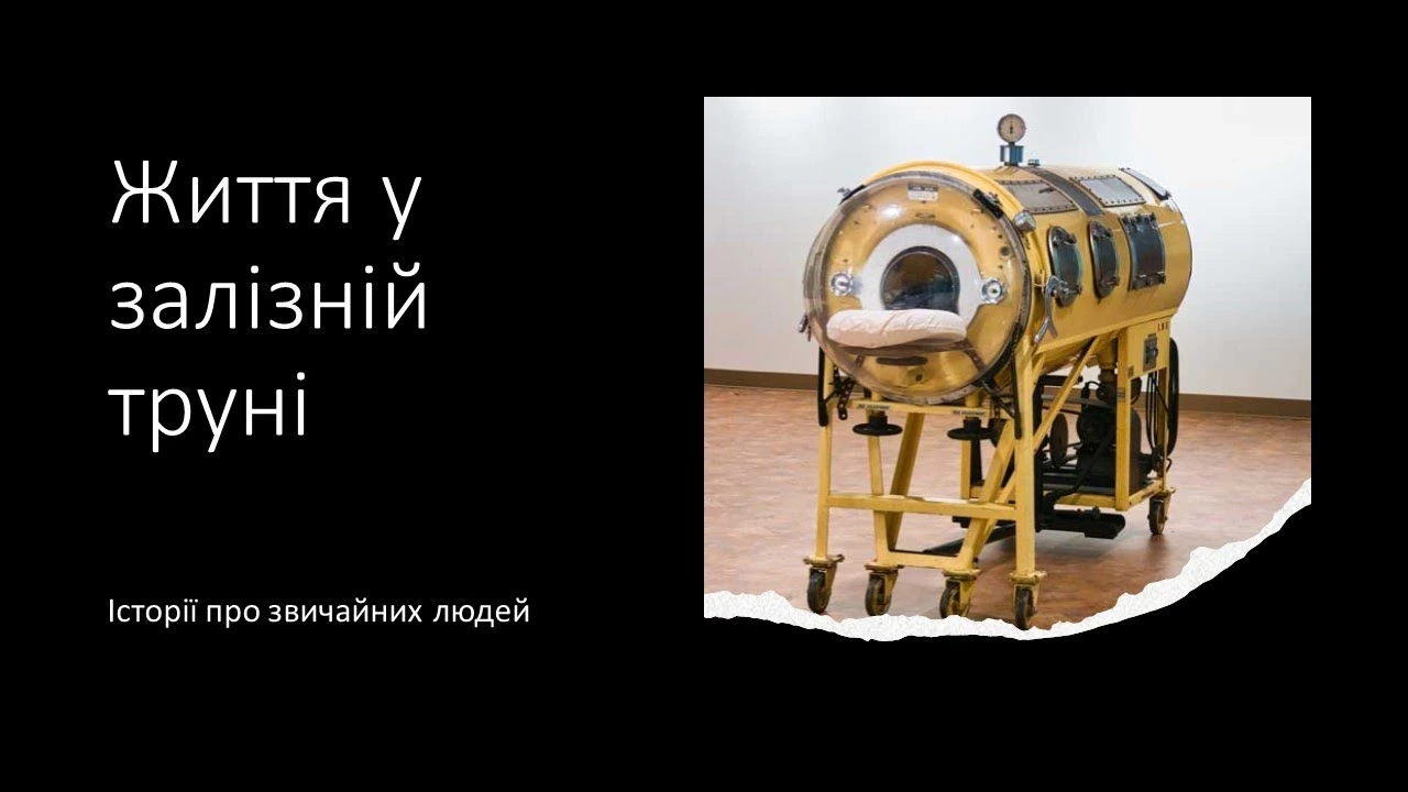 Пол Александер і життя в "залізних легенях": історія наполегливості без прикрас